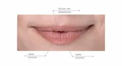 Fillerina® 932 Lips & Mouth Grad 4