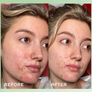 REN Clean Skincare Evercalm Ultra Comforting Rescue Mask 50ml.