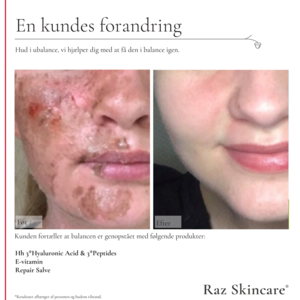 Raz Skincare E Vitamin, 30 ml.