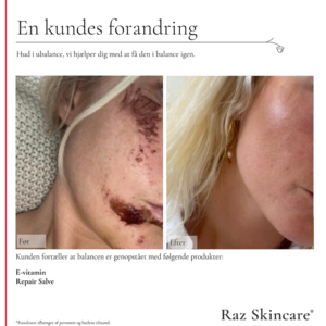 Raz Skincare E Vitamin, 30 ml.