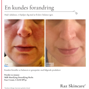 Raz Skincare MdH Serum, 30 ml.