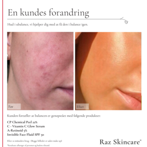 RAZ Skincare A-retinoid 5%, 30ml