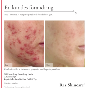 RAZ Skincare A-retinoid 5%, 30ml