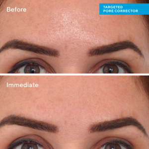 Murad Targeted Pore Corrector, 15ml.