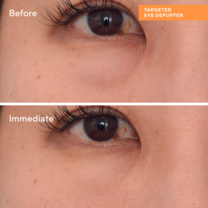 Murad Targeted Eye Depuffer, 15ml.