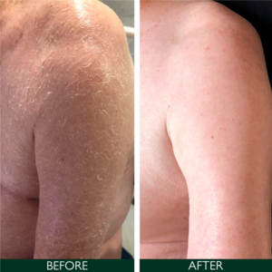 Sorted Skin Intensive Rescue Moisturiser, 100ml.