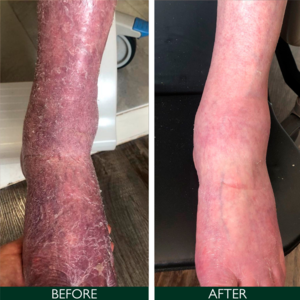 Sorted Skin Intensive Rescue Moisturiser, 100ml.