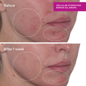 Murad Hydration Cellular Hydration Repair Oil Drops 30ml.